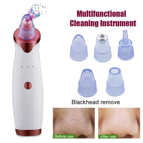 Electric Acne/Blackhead Remover and Vacuum Extractor