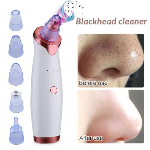 Electric Acne/Blackhead Remover and Vacuum Extractor