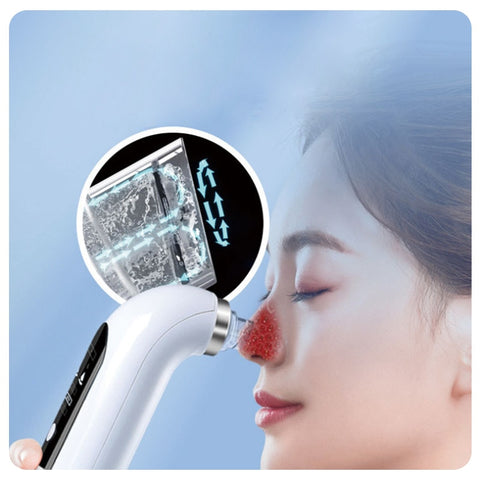 Deep Cleansing Electric  Vacuum Blackhead Remover