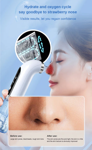 Deep Cleansing Electric  Vacuum Blackhead Remover